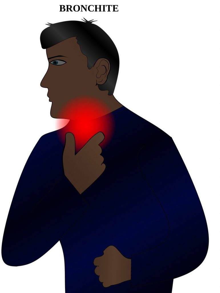 bronchite; inflammation; toux; mal de gorge